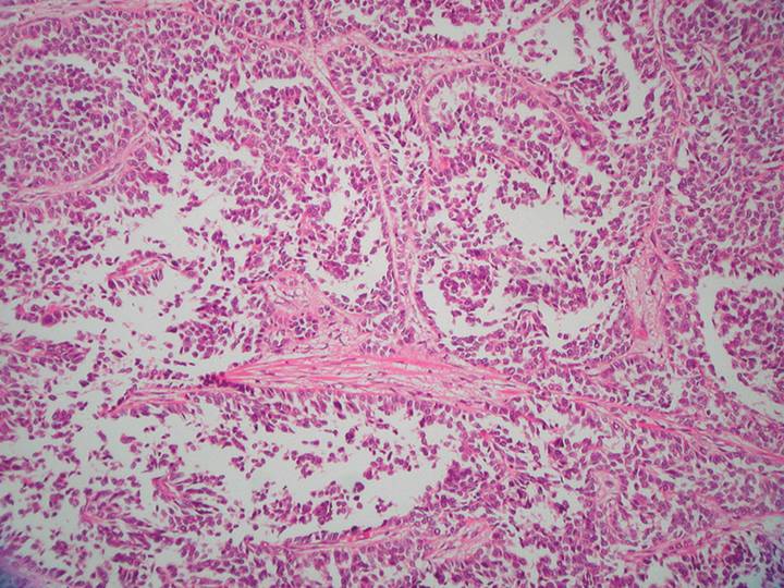 Imagen de Tumor mamario izquierdo/Left mammary tumor.