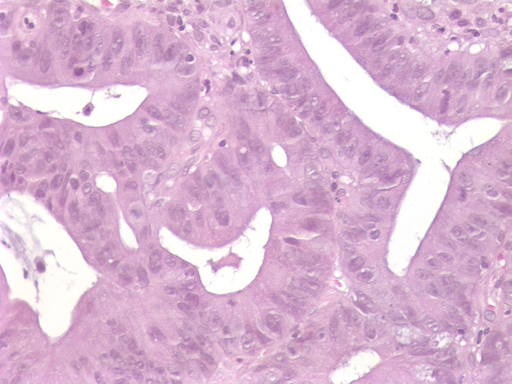 Imagen de Biopsia de colon / Colonic biopsy.