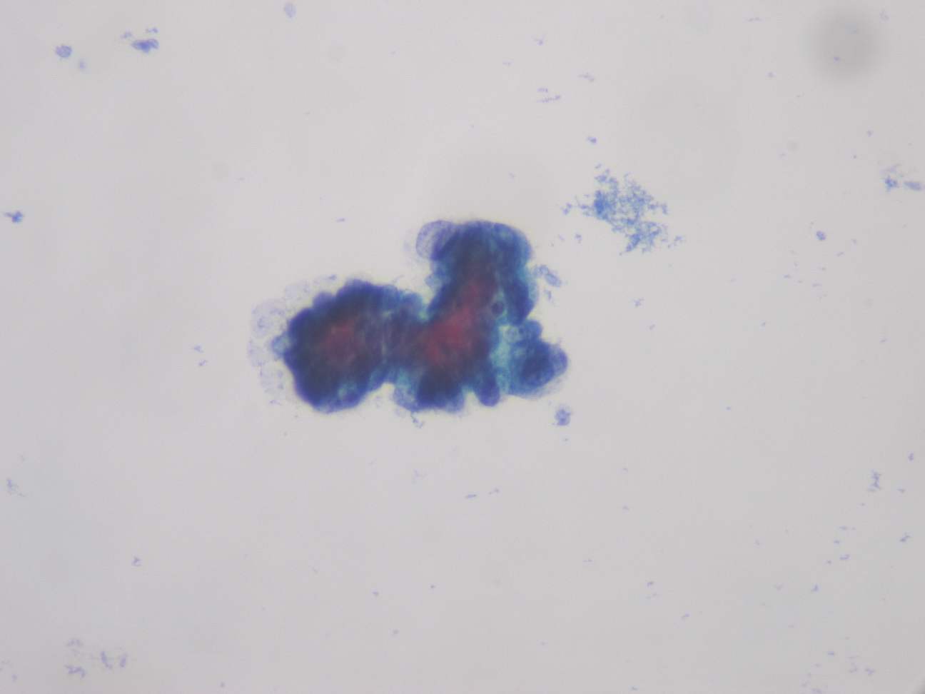 Imagen de Citologa crvico-vaginal en base lquida en mujer de 83 aos  / Cervical-vaginal liquid base citology in 83 year old female.