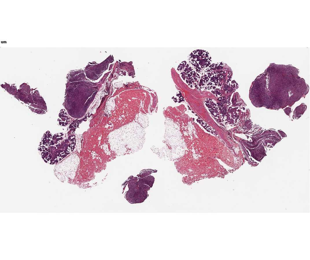 Imagen de Lesiones cutneas eritemato-violceas en mujer joven/Cutaneous erythematous-violaceous lesions in young female.