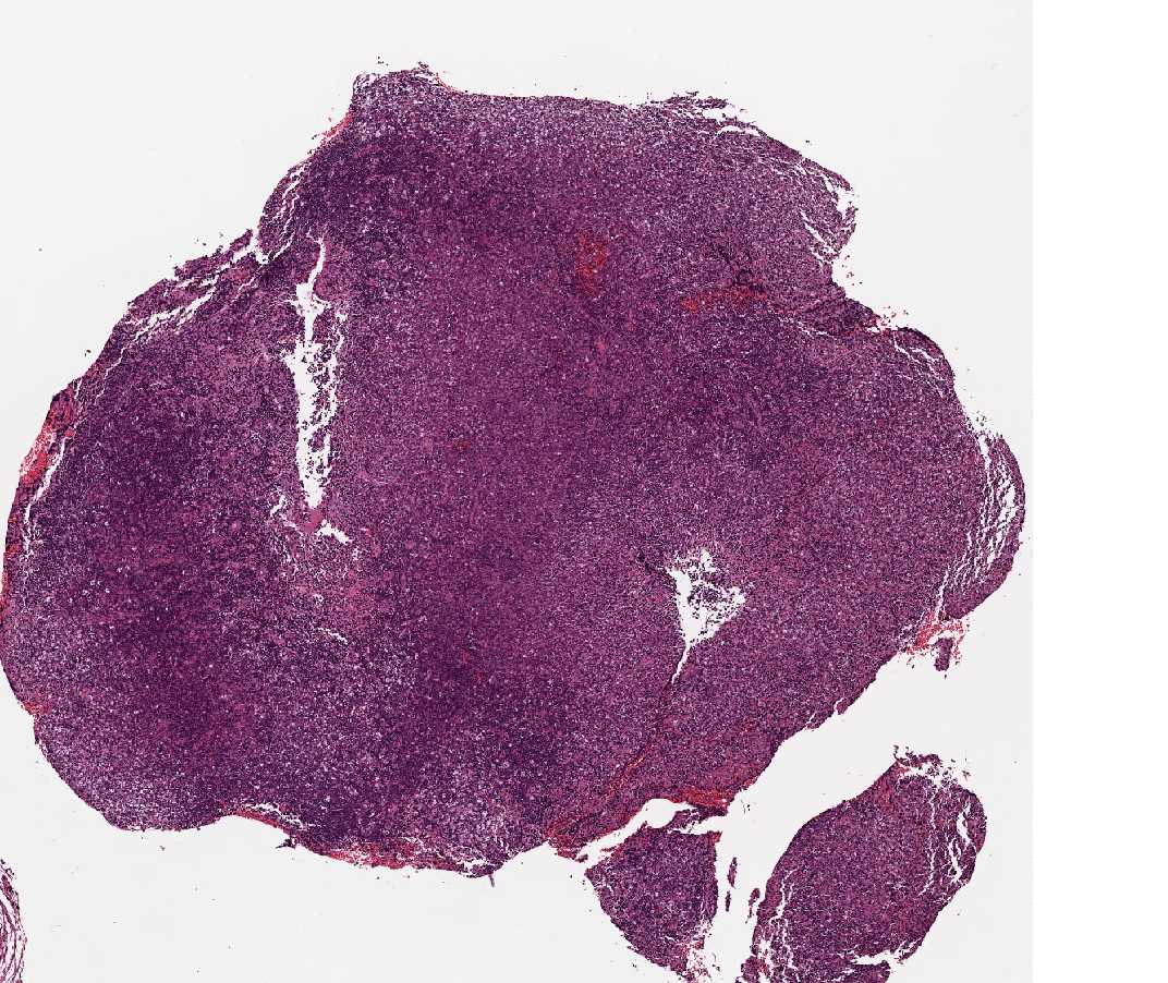 Imagen de Lesiones cutneas eritemato-violceas en mujer joven/Cutaneous erythematous-violaceous lesions in young female.