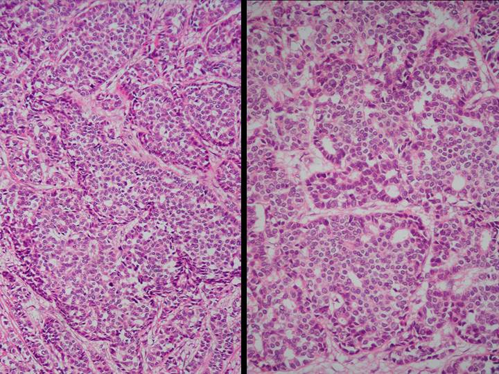 Imagen de Tumor mamario izquierdo/Left mammary tumor.